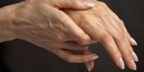 Artriit kae muhke sormede Artriidi liigeste krahhi