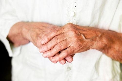 Reumatoidartriidi sormede ennetamine seljavalu lihased ja liigesed
