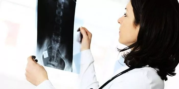 Osteokondroos kaera ravi Liigeste Kuuba ravi