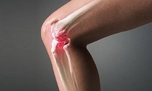 Artriidi artroosi jalgade ravi