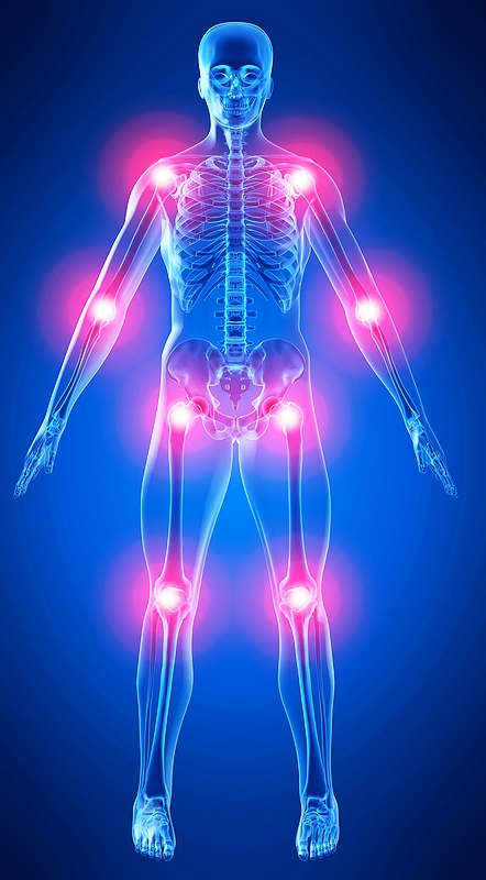 Hip turse endoprotertheetika Perioodilised valud pohjuse liigestes