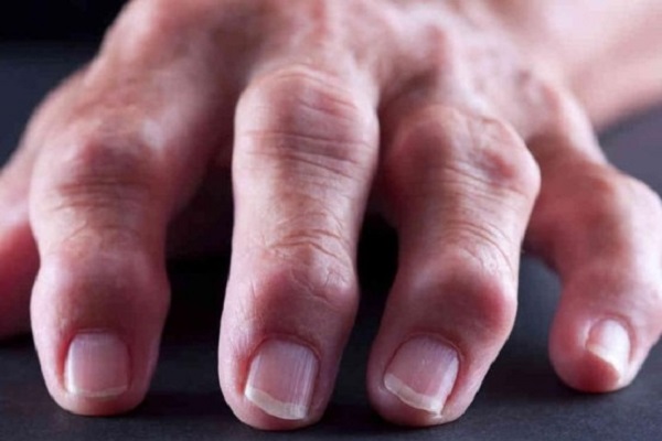 Kondimine valu ajal Valutab suure sorme parema kae liigese
