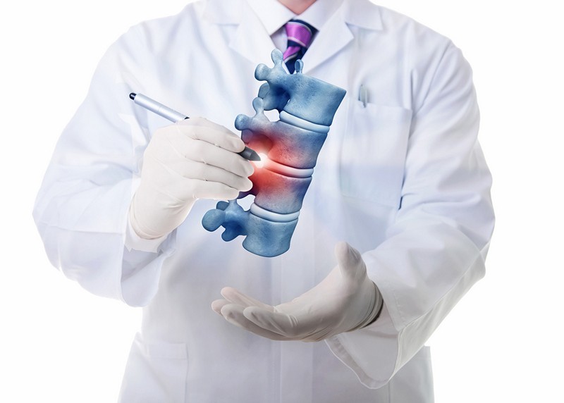Osteokondroosi meditsiinilised tooriistad Kaed valus kaed