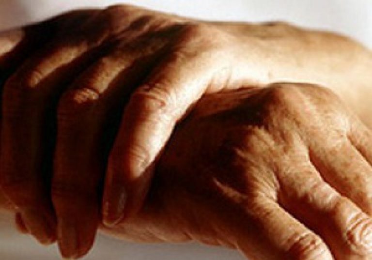 Sormede liigeste artriit artroos Valu leevendusvalu liigestes