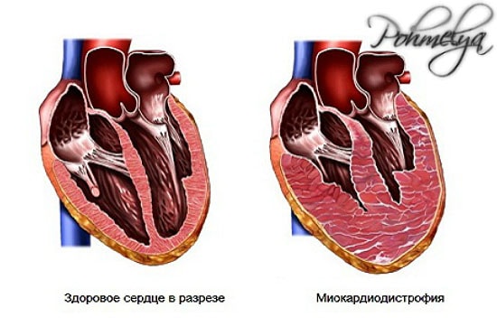 Valu ja pragud uhises kus artroosi toodeldakse