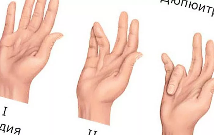 salv artriidi sormede kate kommentaare