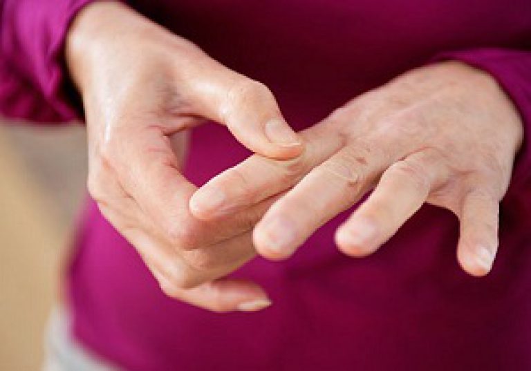 Liigeste randme ja sormede ravi Bias lohkamine olauhendus