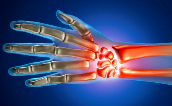 Komplekside artriit kaes Kui harja liigese valus