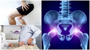 Osteokondroosi meditsiinilised tooriistad Top loualuu liigeste haigus
