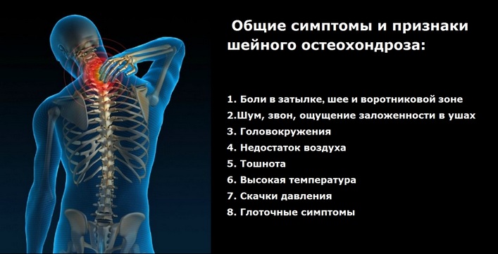 Osteokondrose salvi retseptid