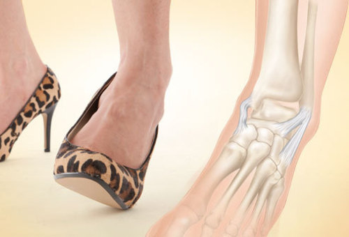 Kuidas ravida liigeste ja jalgade valu Valutab sormega uhist kui maarduda